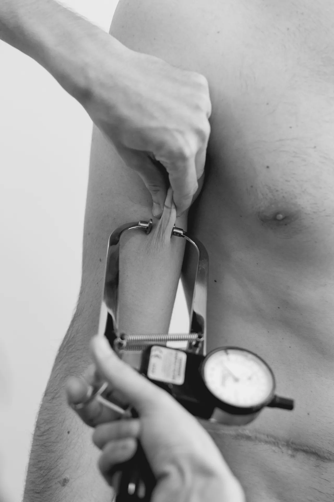 Medición de pliegues cutáneos con plicómetro en una consulta de nutrición
