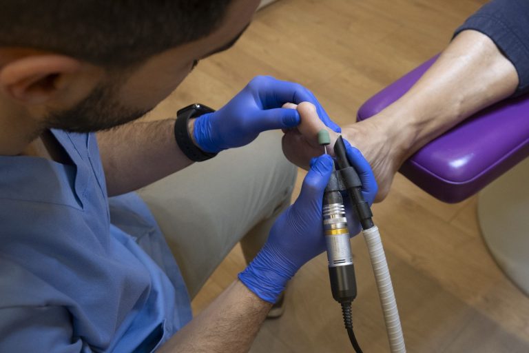 Detalle de un tratamiento de podología con micromotor en Clínica Lebén